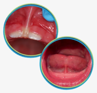 The Services We Offer - Tongue Tied Baby