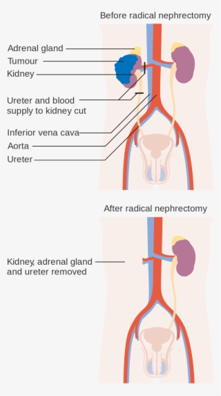Open - Urology