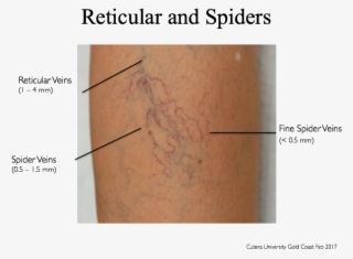 What Not To Treat Hits The Spot - Ua Canada