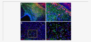 Stroke Lesion Diminished At Day 14 After Brain Ischemia - Common Fig