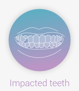 Ebrace Impacted Teeth - Circle