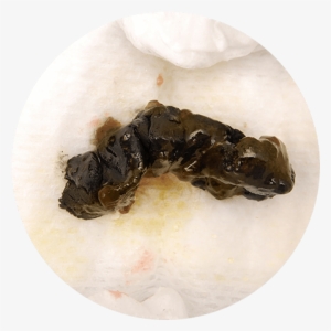 Discover What Causes Black Baby Poop With The Similac® - Black Chunks