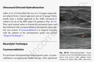 13 Ultrasound Image Of The Ilioinguinal And Iliohypogastric - Ilioinguinal Nerve Ultrasound Nerves