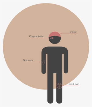 The World Health Organization Has Labeled The Zika - Circle
