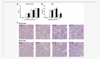 Renal Injury In Wt And Nod1/2 Dko (black Bars) Mice - Common Fig