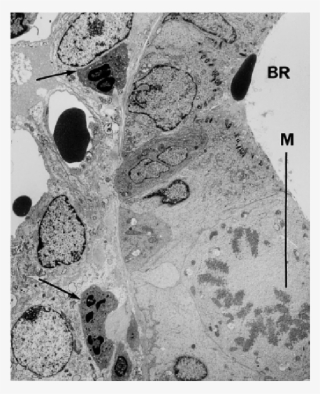Em Of An Area Near The End Of A Bronchiole After Coexposure - Epithelium