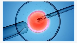Ivf Possible Despite A Semen Report Showing Dead Sperm - Ivf