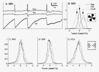 A E Eye Movements When Viewing Rotation - Diagram