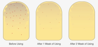 Had Puss In Them - Boots Tea Tree & Witch Hazel Back Spray 150ml