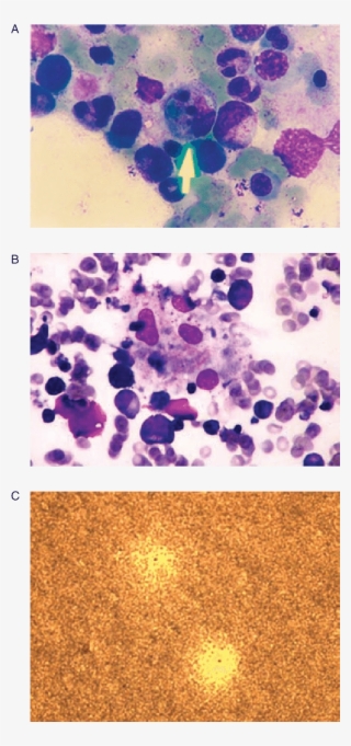 Light Microscope Image Showing Macrophages Phagocytizing - Microscope