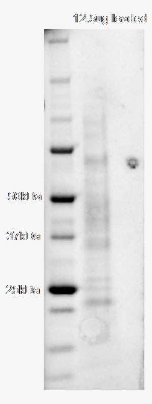Sds Page Of Purified Protein - User Guide