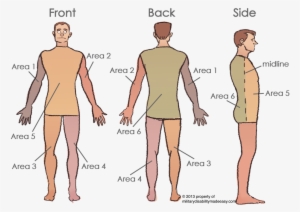 Scar Areas 2 - Body Surface Area