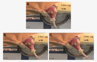 Pictures Of The Automatic Arthrometer Developed By - Joint