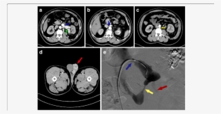 Additional Radiological Examination Of The Patient - Common Fig