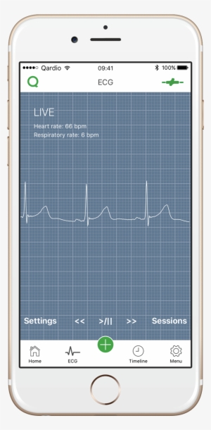 Ecg/ekg Trace Qardio App