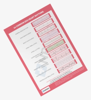 Most Nurses Have To Interpret Ekg Rhythms Every Day - Electrocardiography