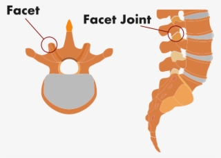 Facet Joint, Spinal Injury, Facet Joint Injury, Where - Pain In Spine