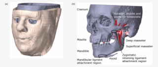 Subject-specific Face Model - Computed Tomography