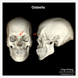 Radiology Quiz 40462 - Nasion Skull