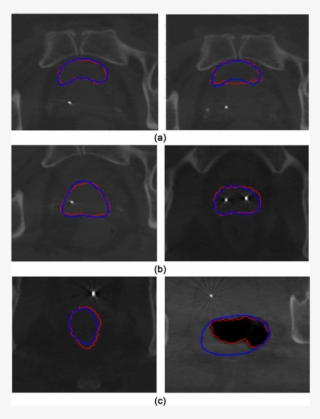 Contour Comparison Between The Segmentation And Ground - Circle