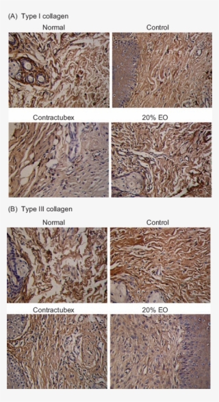 Immunohistochemical Reactivities Of Collagens I And - Granite