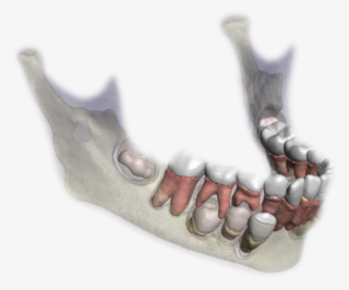 3d Model Of A Jaw - Human Tooth