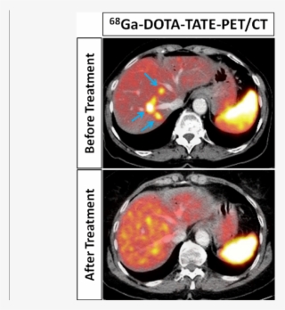 Download - Dota-tate