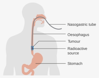Open - Diagram Of The Oesophagus
