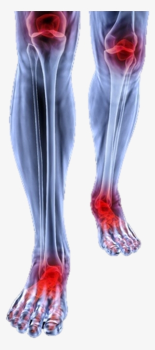 Foot Pain And Knee Pain - Joint Pain Transparent Background