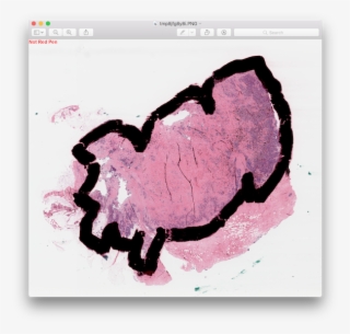 Not Red Pen, Red Pen - Illustration