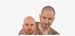 Bald - Hair Loss