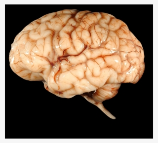 Brain Png