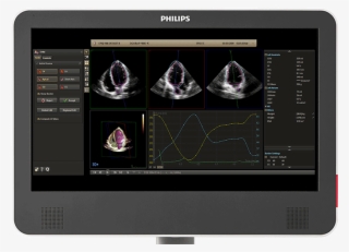 Dynamic Heart Model - Heart