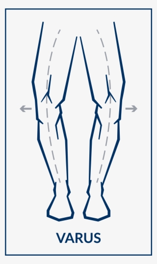 Aryse Varus Oa Knee Brace - Varus Deformity
