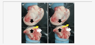 Lateral View Of Porcine Knee Joint - Varus Deformity