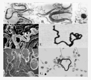 Figures 5a Through 5g - Tb Virus Under Microscope