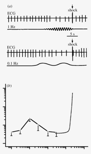 Conditioned Cardiac Response (slowing Of The Heart - Diagram