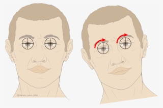 Open - Vestíbulo Ocular