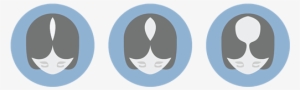 What Causes Women's Hair Loss - Pittsburgh