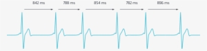 Between Every Heartbeat Is An Interval Of Variable - Heart Rate Variability Png