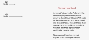 Normal Heartbeat Heart Block Bradycardia Atrial Tachycardia - Ventricular Fibrillation Heart