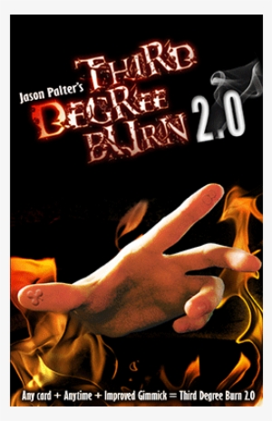 Today, When You Order "third Degree Burn - Third Degree Burn Magic