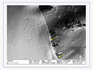 Sem-image Of An Anterior Lens Capsule Following Manual - Capsulorhexis