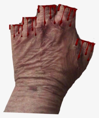 0 Scars