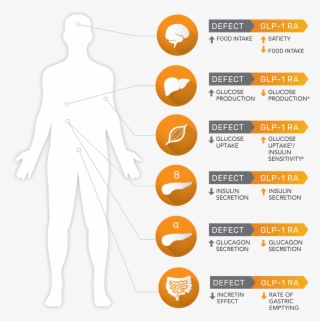 Defects Of Type 2 Diabetes