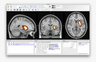 You Can Do The Same Thing For The "harvard-oxford Cortical