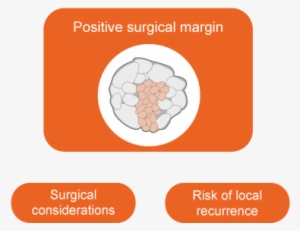 Partial Versus Radical Nephrectomy Oncology - Parallel
