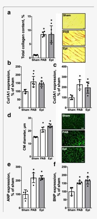 Eplerenone Has No Direct Effect On Pressure Overload-induced