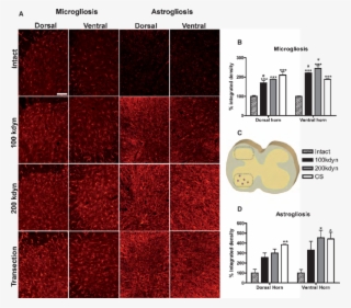 Chronic Gliosis In The Spinal Cord