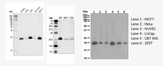 Cdkn1a Antibodies Cst Abcam Right